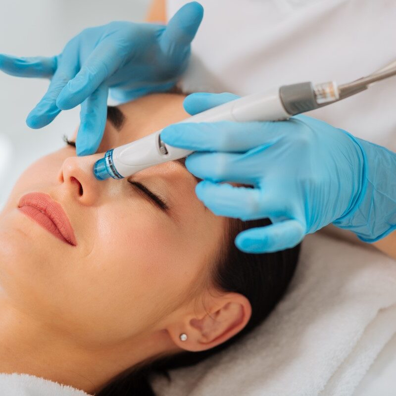 HydraFacials treatment - In My Skin Clinic